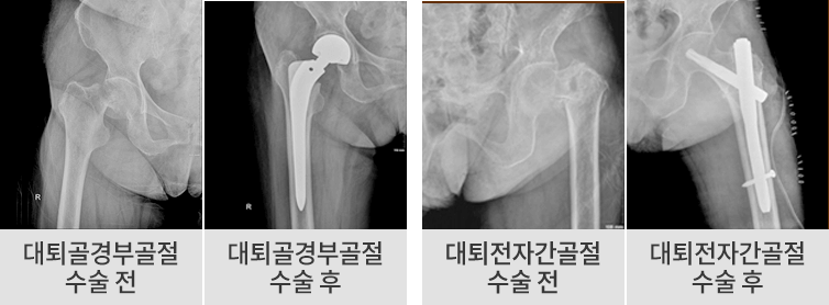 수술 전후 이미지