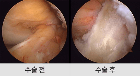 수술 전후 이미지