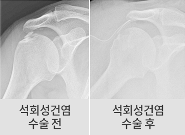 수술 전후 이미지