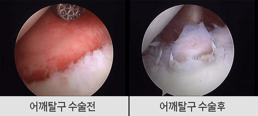 수술 전후 이미지