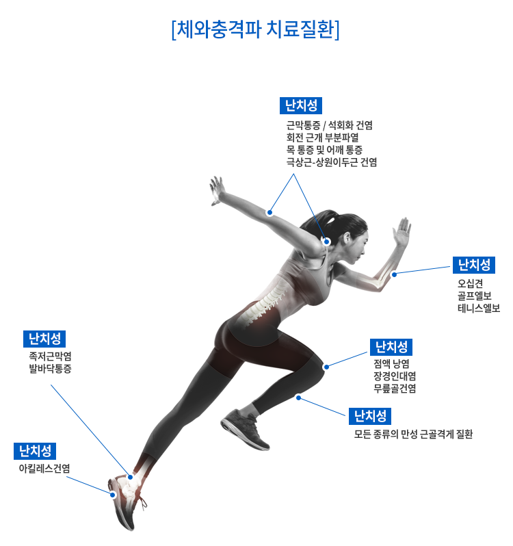 체외충격파 치료질환 이미지